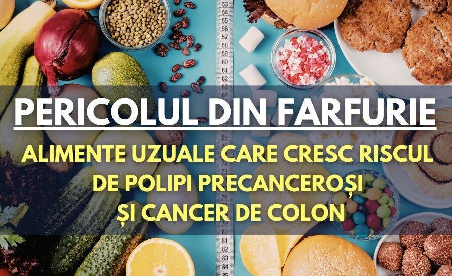 Alimente care cresc riscul de cancer colorectal