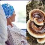 Un supliment mai mult decat necesar in afectiunile tumorale