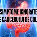 Simptome ignorate ale cancerului de colon