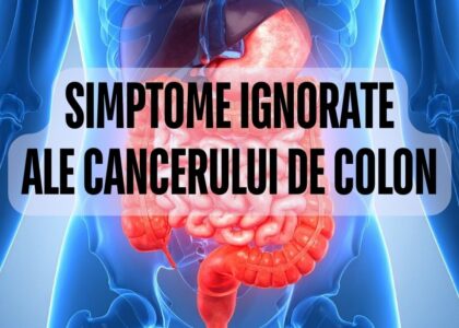 Simptome ignorate ale cancerului de colon