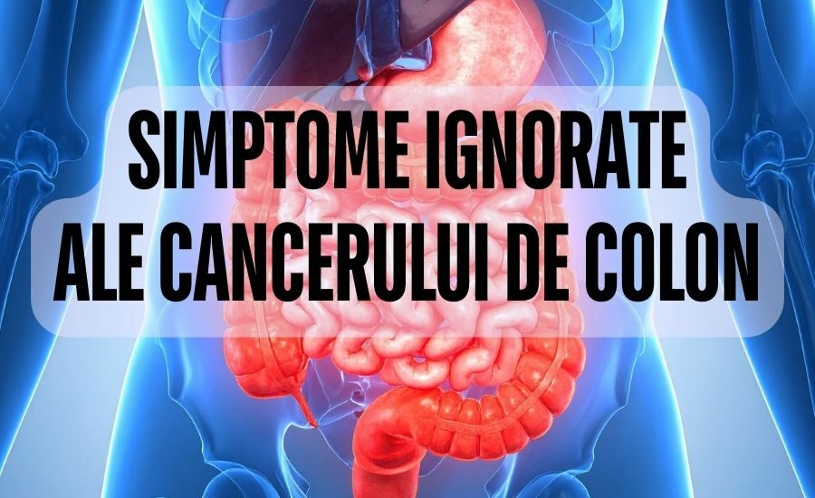 Simptome ignorate ale cancerului de colon
